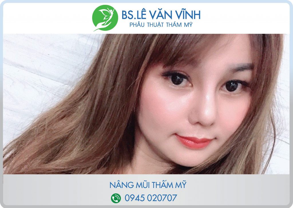 Nang mui S Line 3D