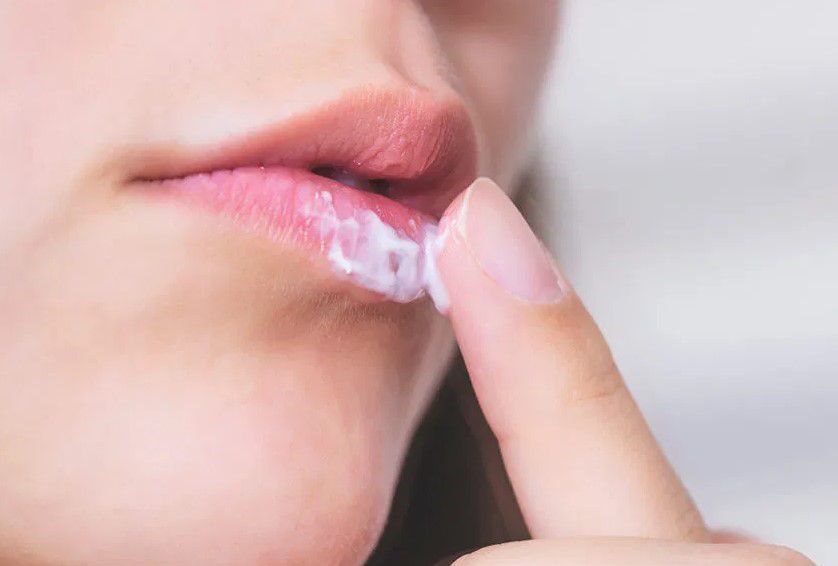 Tìm hiểu bệnh chàm môi là gì  Nguyên nhân cách điểu trị tận gốc