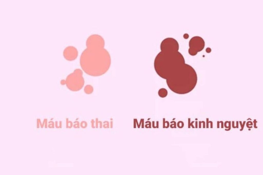 Chậm kinh sau khi quan hệ, xuất tinh ra máu có thai không?
