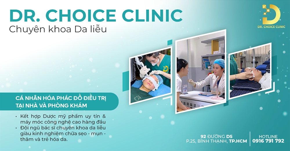 tiêm filler tphcm
