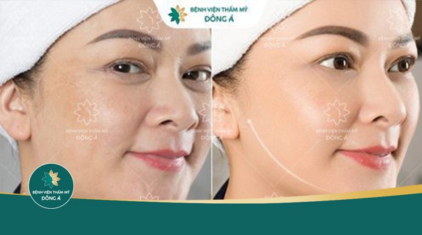 Bác sĩ Căng da mặt giỏi tphcm