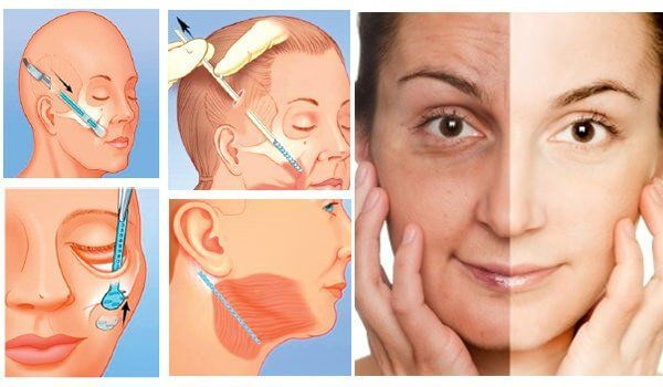 Bác sĩ Căng da mặt giỏi hcm