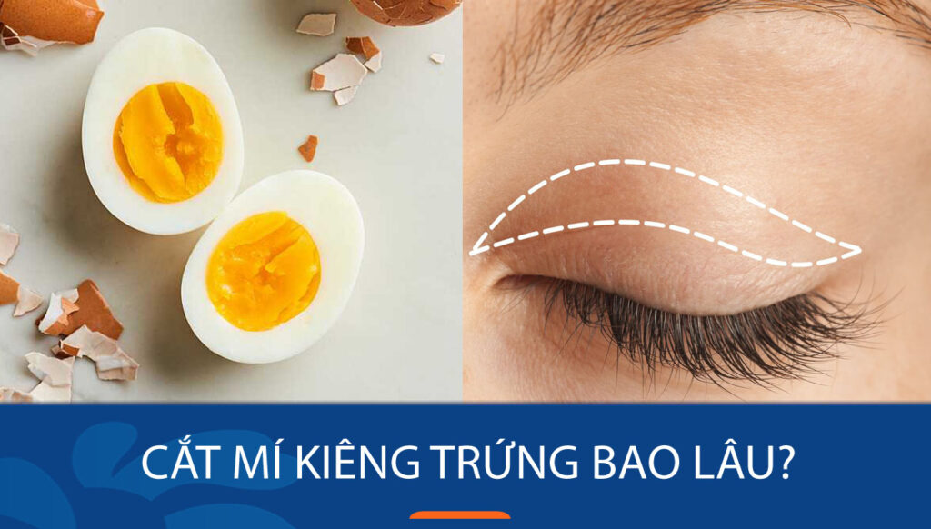 Cắt mí mắt có nên ăn trứng gà không ?