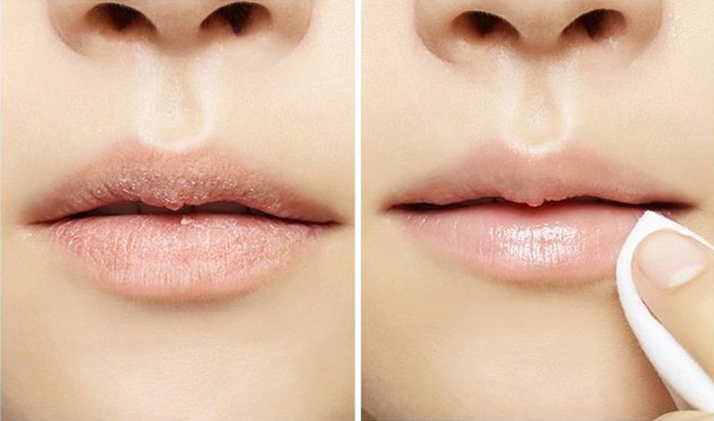 Có những cách nào làm môi nhỏ lại không ?
