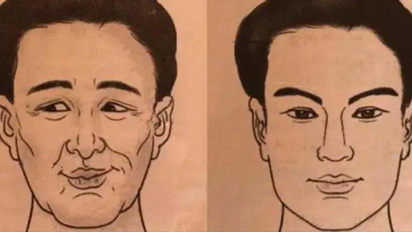 Xương lông mày nhô cao tốt hay xấu ?