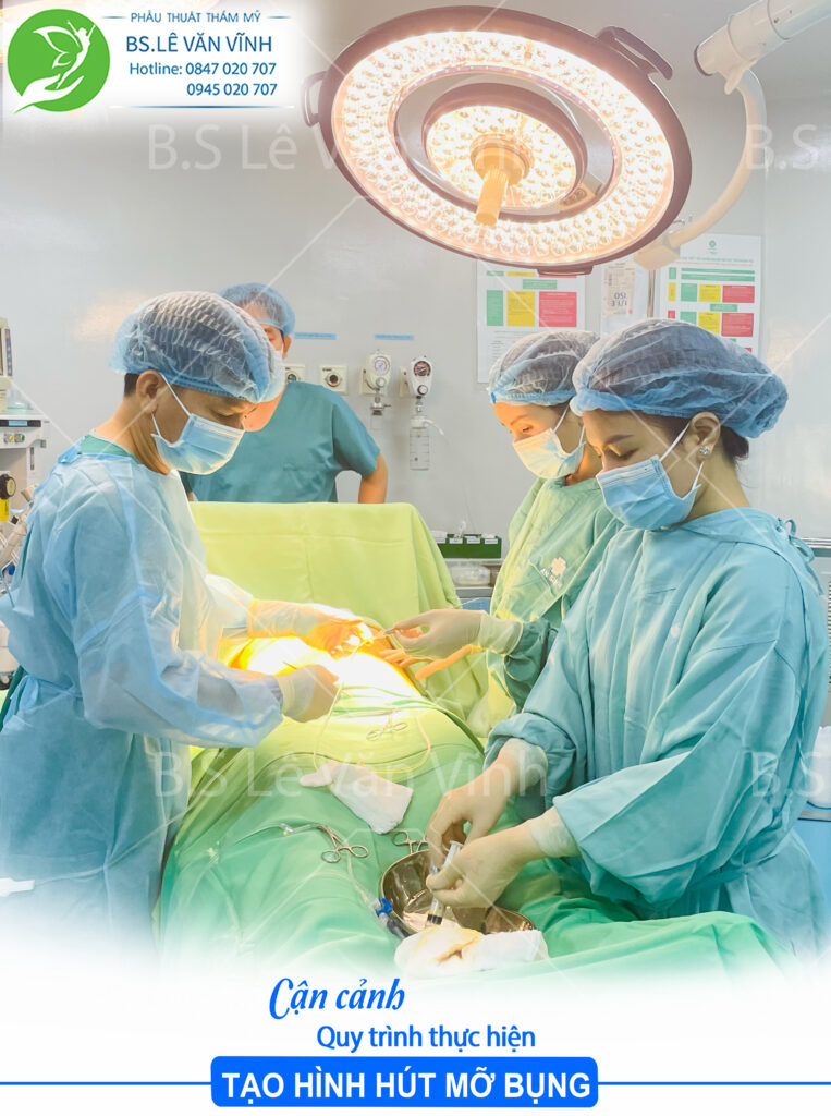 Quy trình hút mỡ bụng nam chuẩn y khoa