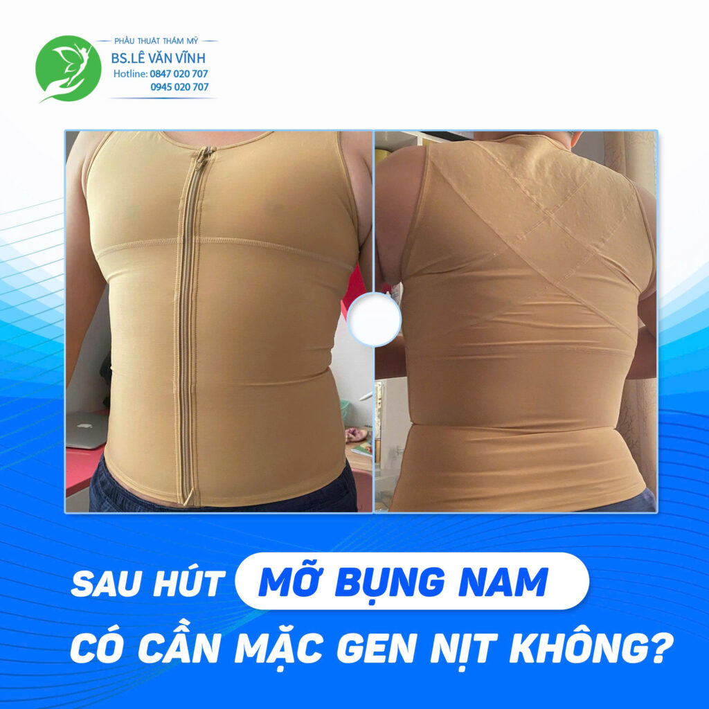 Sau hút mỡ bụng nam có cần mặc gen nịt không?